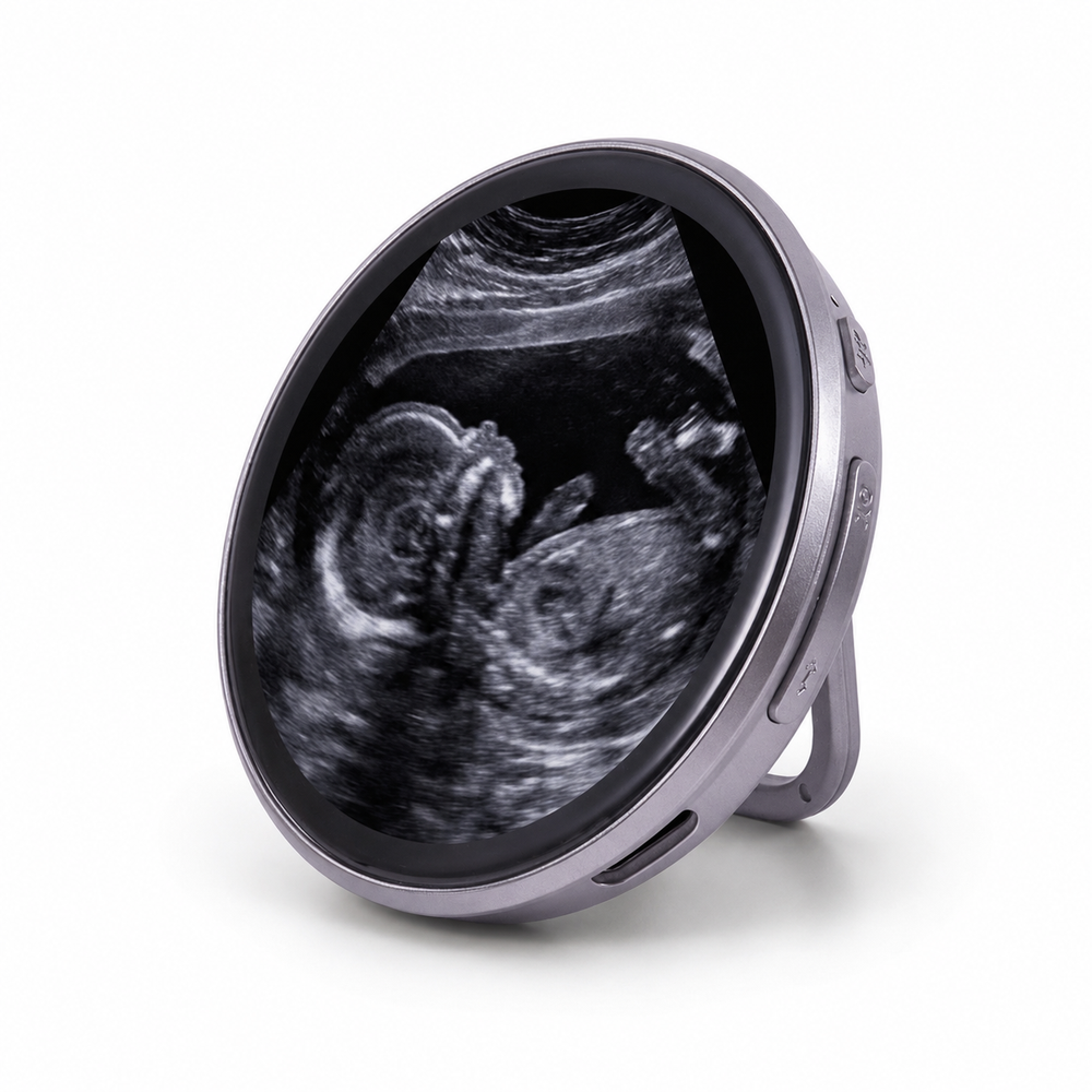 Ultrasound keepsake detail